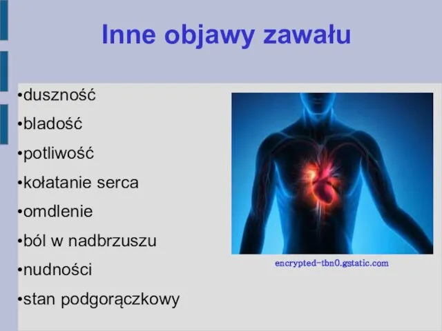 duszność bladość potliwość kołatanie serca omdlenie ból w nadbrzuszu nudności stan podgorączkowy Inne objawy zawału encrypted-tbn0.gstatic.com