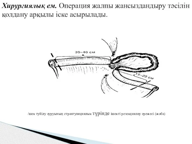 Хирургиялық ем. Операция жалпы жансыздандыру тәсілін қолдану арқылы іске асырылады.