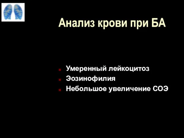 Анализ крови при БА Умеренный лейкоцитоз Эозинофилия Небольшое увеличение СОЭ