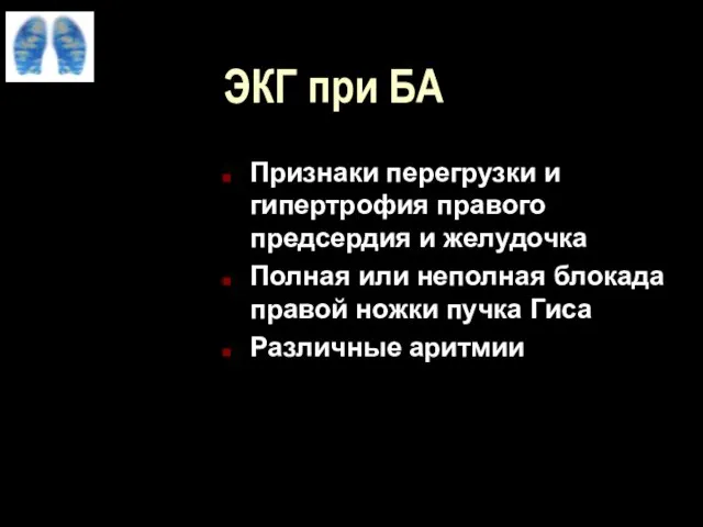 ЭКГ при БА Признаки перегрузки и гипертрофия правого предсердия и желудочка