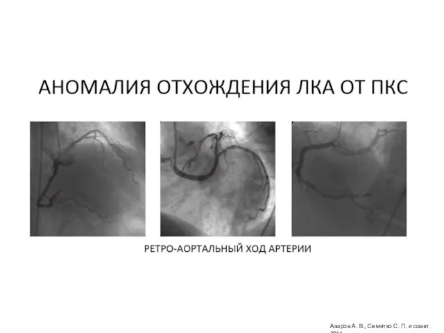 Азаров А. В., Семитко С. П. и соавт. 2014