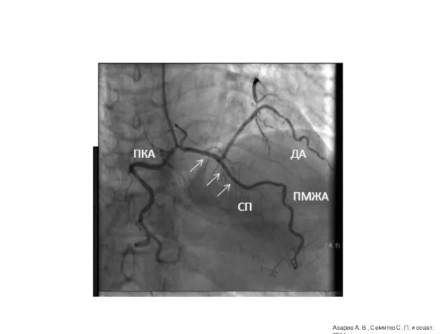 Азаров А. В., Семитко С. П. и соавт. 2014