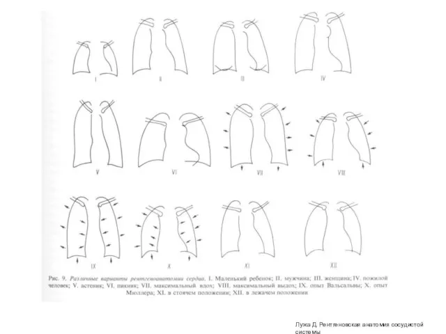 Лужа Д. Рентгеновская анатомия сосудистой системы