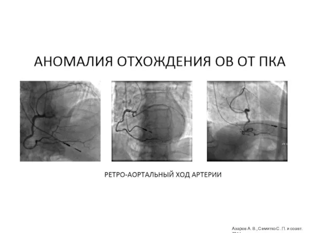 Азаров А. В., Семитко С. П. и соавт. 2014