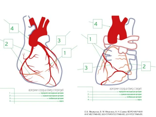 Е.В. Меркулов, В. М. Миронов, А. Н. Самко КОРОНАРНАЯ АНГИОГРАФИЯ, ВЕНТРИКУЛОГРАФИЯ, ШУНТОГРАФИЯ.