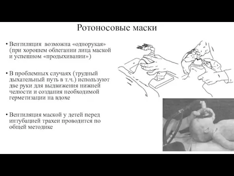 Ротоносовые маски Вентиляция возможна «однорукая» (при хорошем облегании лица маской и