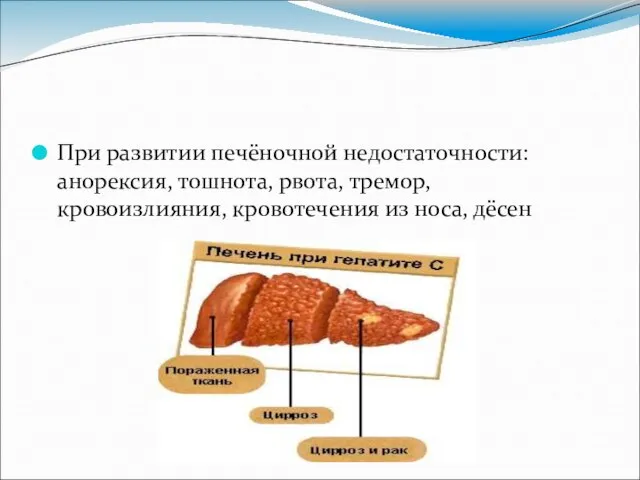 При развитии печёночной недостаточности: анорексия, тошнота, рвота, тремор, кровоизлияния, кровотечения из носа, дёсен