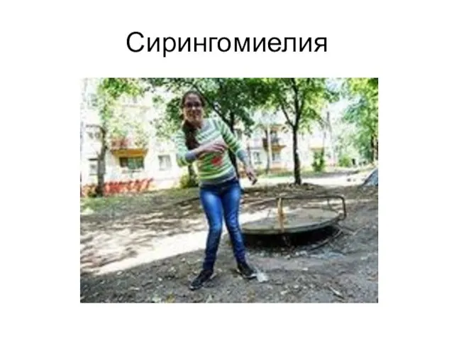 Сирингомиелия