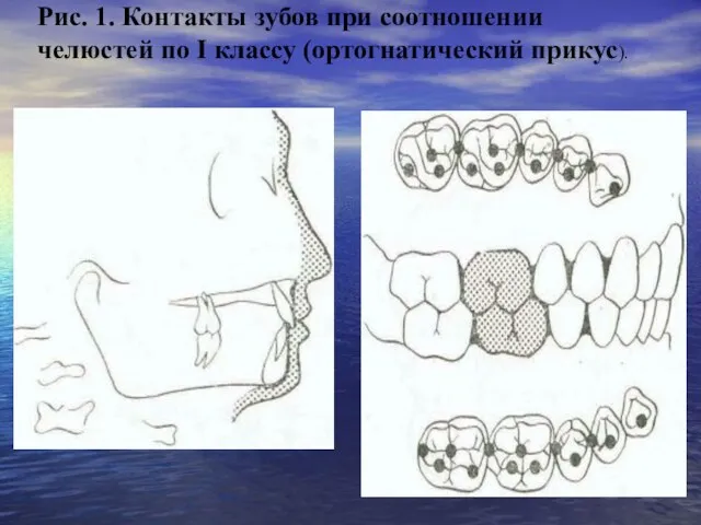 Рис. 1. Контакты зубов при соотношении челюстей по I классу (ортогнатический прикус).