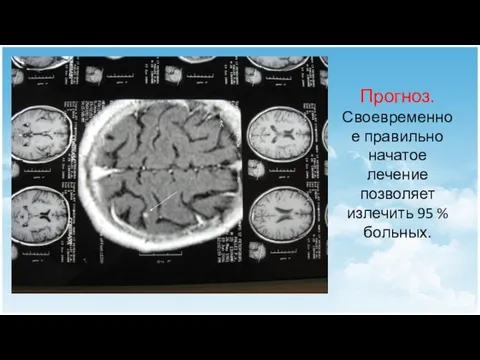 Прогноз. Своевременное правильно начатое лечение позволяет излечить 95 % больных.