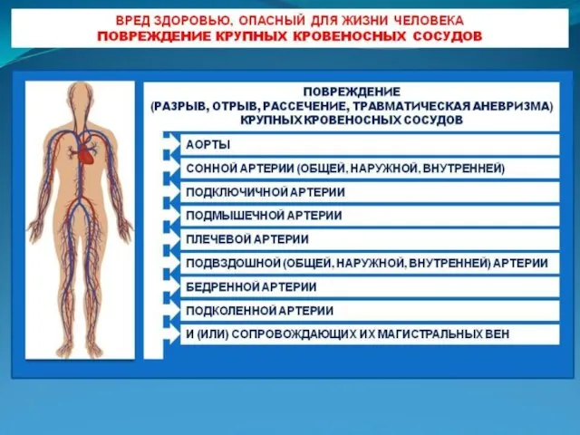 Вред здоровью, опасный для жизни человека