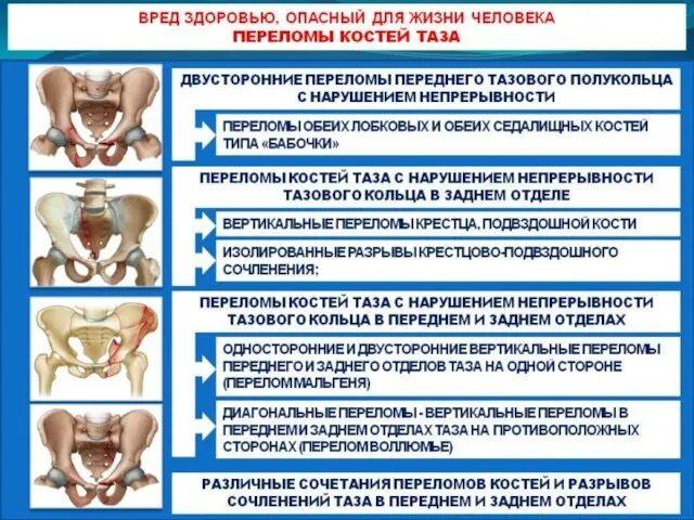 Вред здоровью, опасный для жизни человека