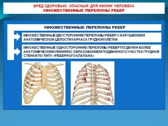 Вред здоровью, опасный для жизни человека