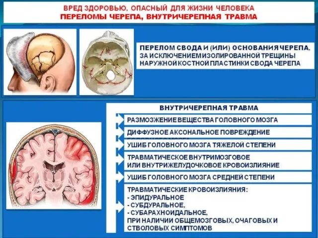 Вред здоровью, опасный для жизни человека