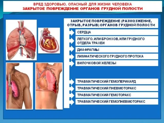 Вред здоровью, опасный для жизни человека