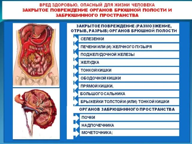 Вред здоровью, опасный для жизни человека