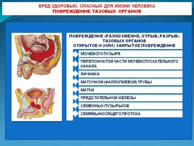 Вред здоровью, опасный для жизни человека