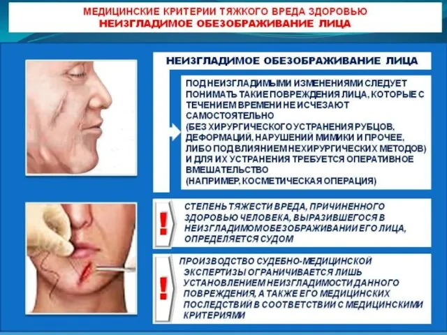 Неизгладимое обезображивание лица