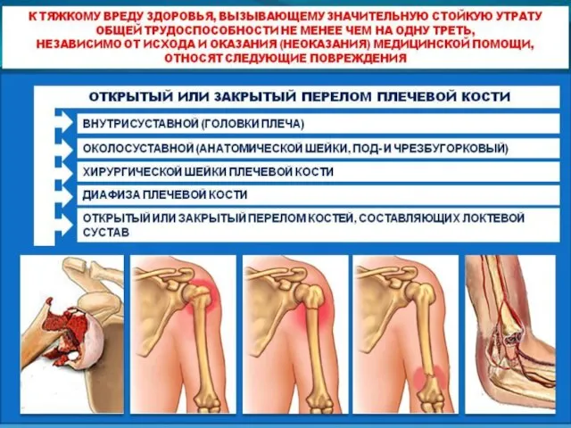 Значительная утрата общей трудоспособности