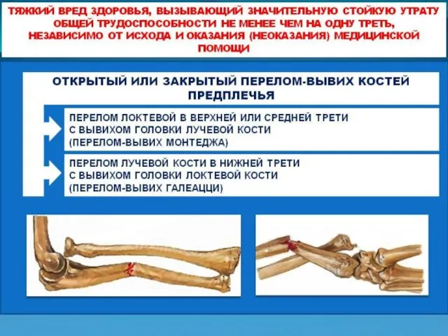 Значительная утрата общей трудоспособности