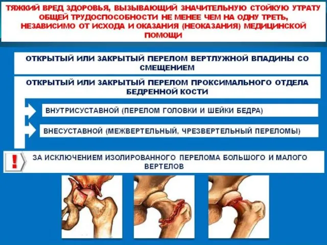 Значительная утрата общей трудоспособности