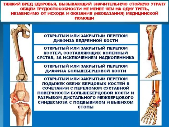 Значительная утрата общей трудоспособности