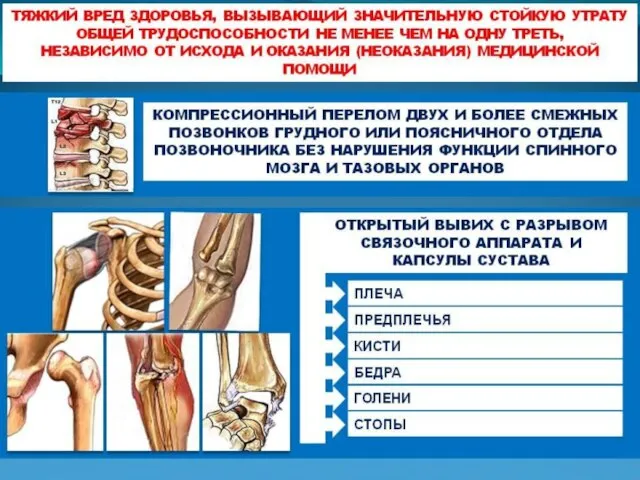 Значительная утрата общей трудоспособности