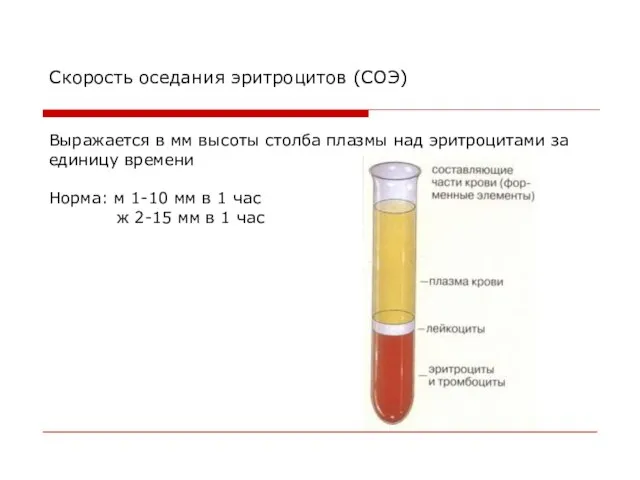 Скорость оседания эритроцитов (СОЭ) Выражается в мм высоты столба плазмы над