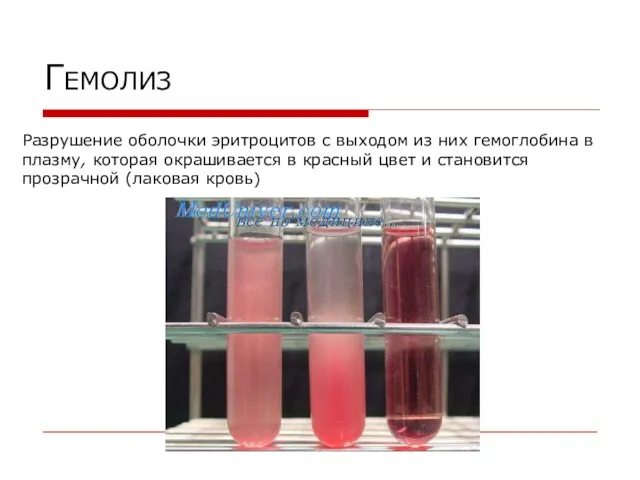 ГЕМОЛИЗ Разрушение оболочки эритроцитов с выходом из них гемоглобина в плазму,