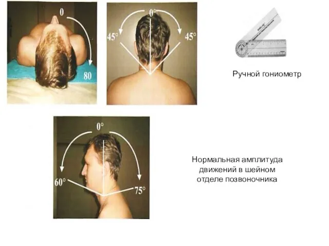 Нормальная амплитуда движений в шейном отделе позвоночника Ручной гониометр