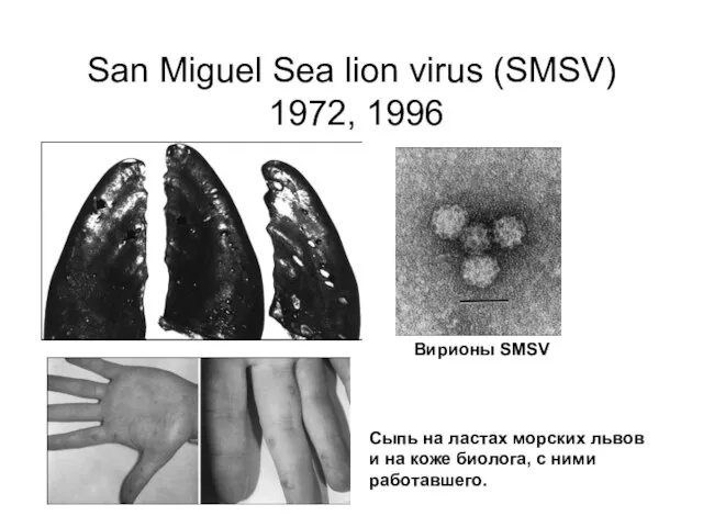 San Miguel Sea lion virus (SMSV) 1972, 1996 Сыпь на ластах