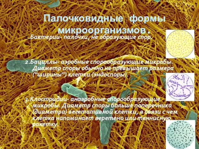 Палочковидные формы микроорганизмов. 1.Бактерии- палочки, не образующие спор. 2.Бациллы- аэробные спорообразующие