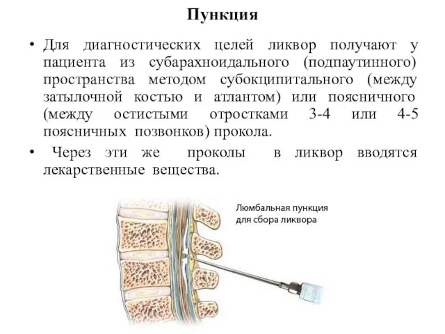 Пункция Для диагностических целей ликвор получают у пациента из субарахноидального (подпаутинного)