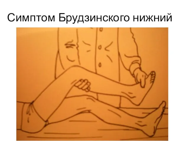 Симптом Брудзинского нижний