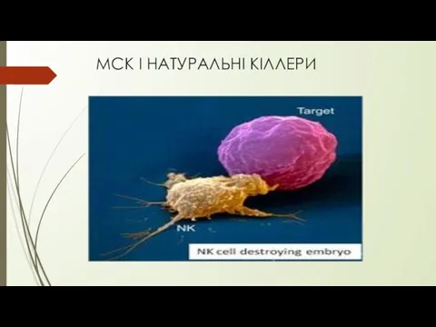 МСК І НАТУРАЛЬНІ КІЛЛЕРИ