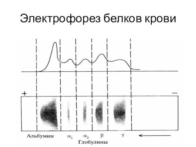 Электрофорез белков крови