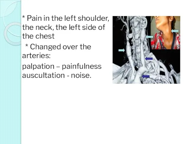 * Pain in the left shoulder, the neck, the left side