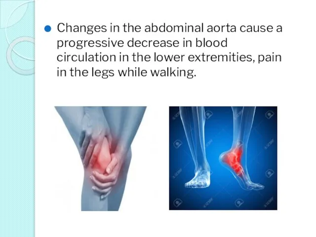 Changes in the abdominal aorta cause a progressive decrease in blood