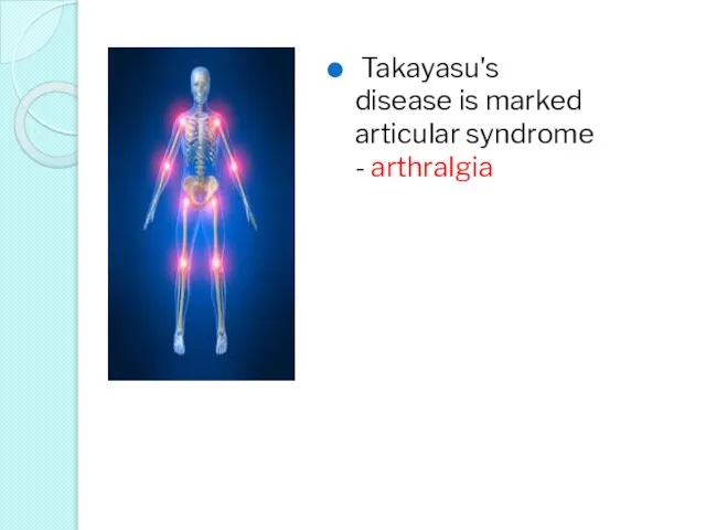 Takayasu's disease is marked articular syndrome - arthralgia