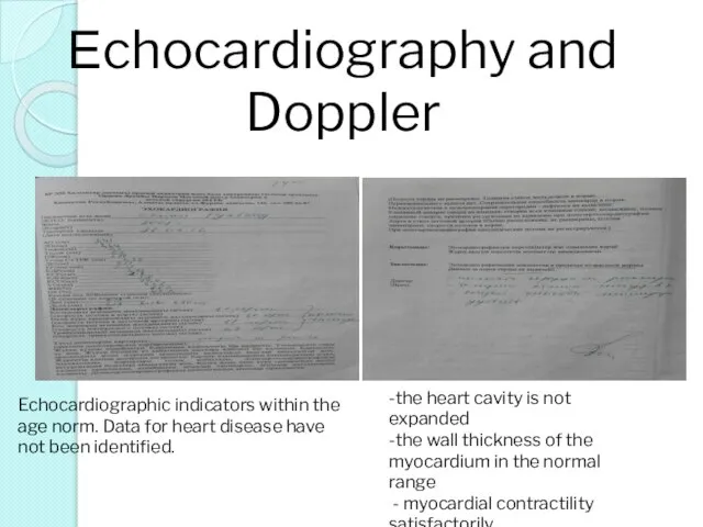 Еchocardiography and Doppler -the heart cavity is not expanded -the wall