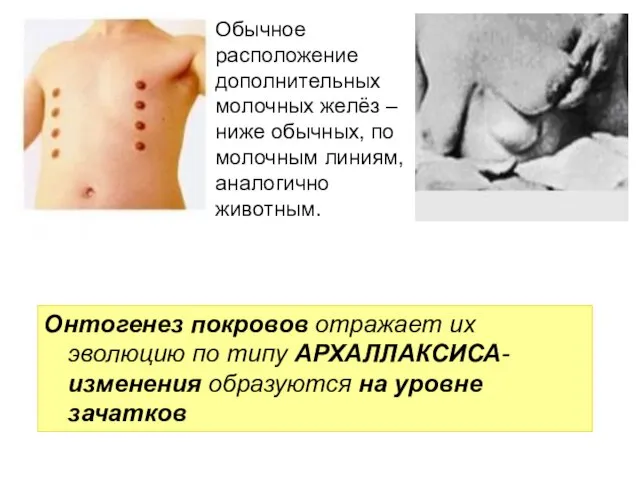 Обычное расположение дополнительных молочных желёз – ниже обычных, по молочным линиям,