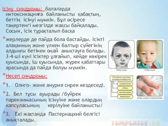 Ісіну синдромы: балаларда интоксикацияға байланысты қабақтың, беттің ісінуі мүмкін. Бұл әсіресе