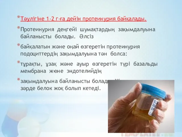 Тәулігіне 1-2 г-ға дейін протеинурия байқалады. Протеинурия деңгейі шумақтардың зақымдалуына байланысты