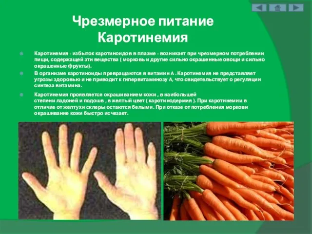 Чрезмерное питание Каротинемия Каротинемия - избыток каротиноидов в плазме - возникает