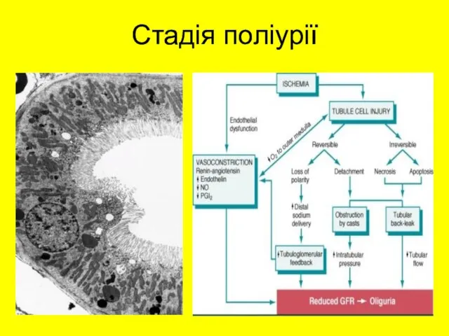 Стадія поліурії