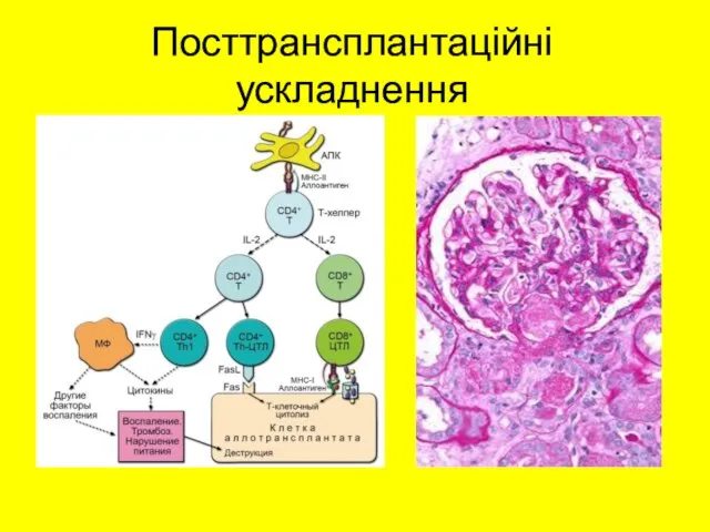 Посттрансплантаційні ускладнення