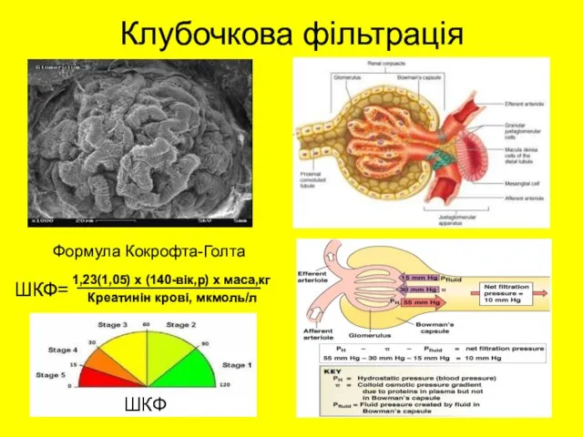 Клубочкова фільтрація Формула Кокрофта-Голта _________________ Креатинін крові, мкмоль/л 1,23(1,05) х (140-вік,р) х маса,кг ШКФ= ШКФ