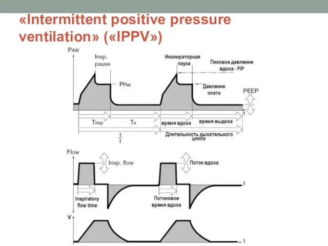 «Intermittent positive pressure ventilation» («IPPV»)