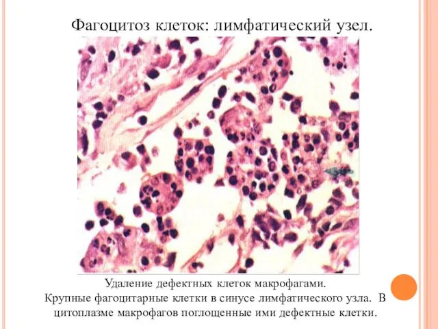 Фагоцитоз клеток: лимфатический узел. Удаление дефектных клеток макрофагами. Крупные фагоцитарные клетки