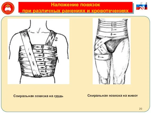 Наложение повязок при различных ранениях и кровотечениях 20 Спиральная повязка на грудь Спиральная повязка на живот